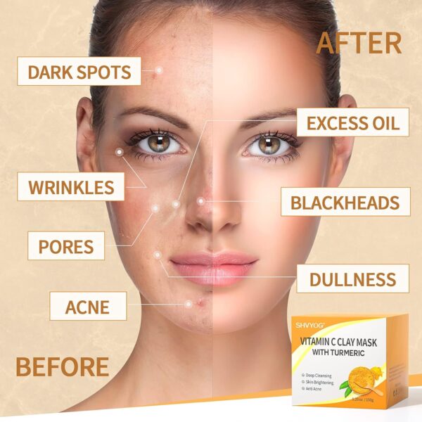 Vitamin C Face Mask - Image 5